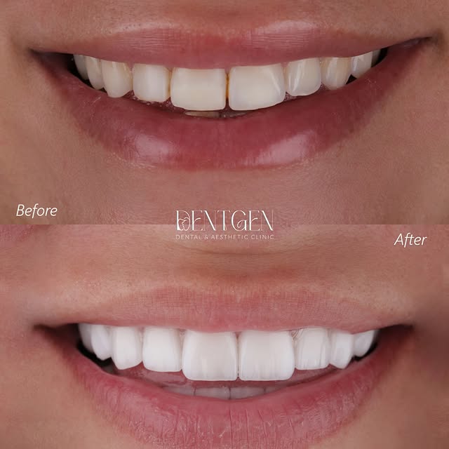 Current DentGen Instagram smile post