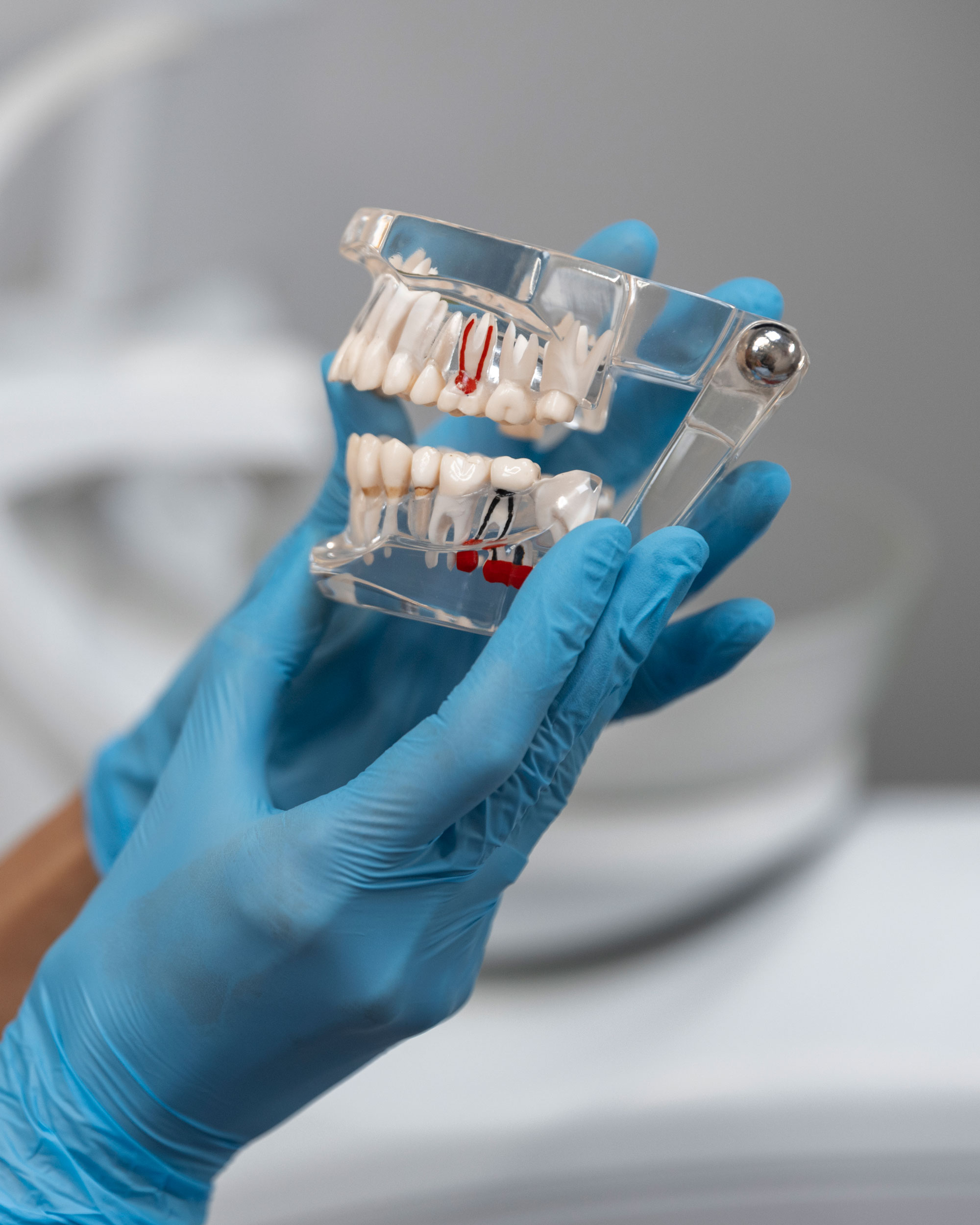 Dental Implants in Dubai