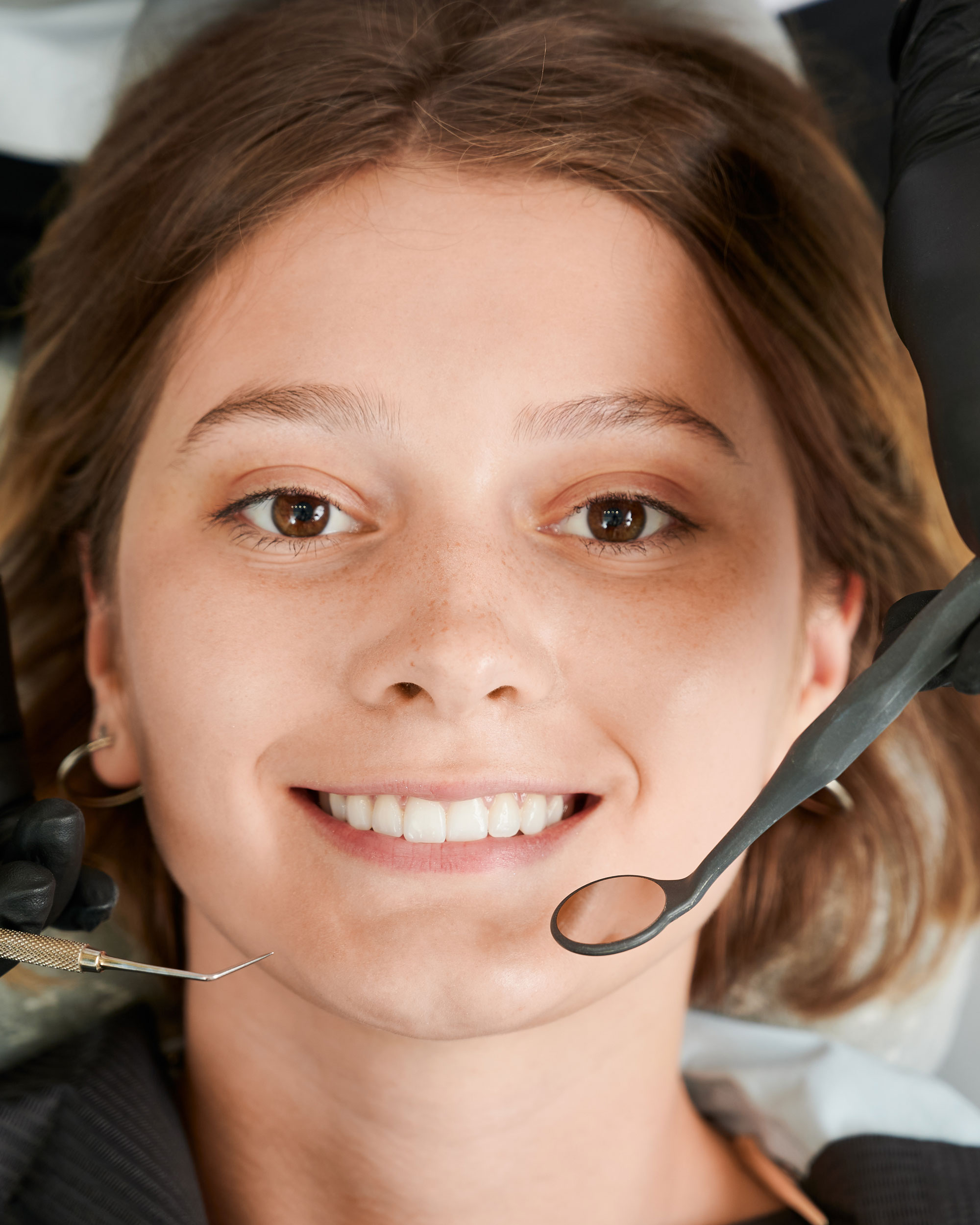 Smile Makeover in Dubai