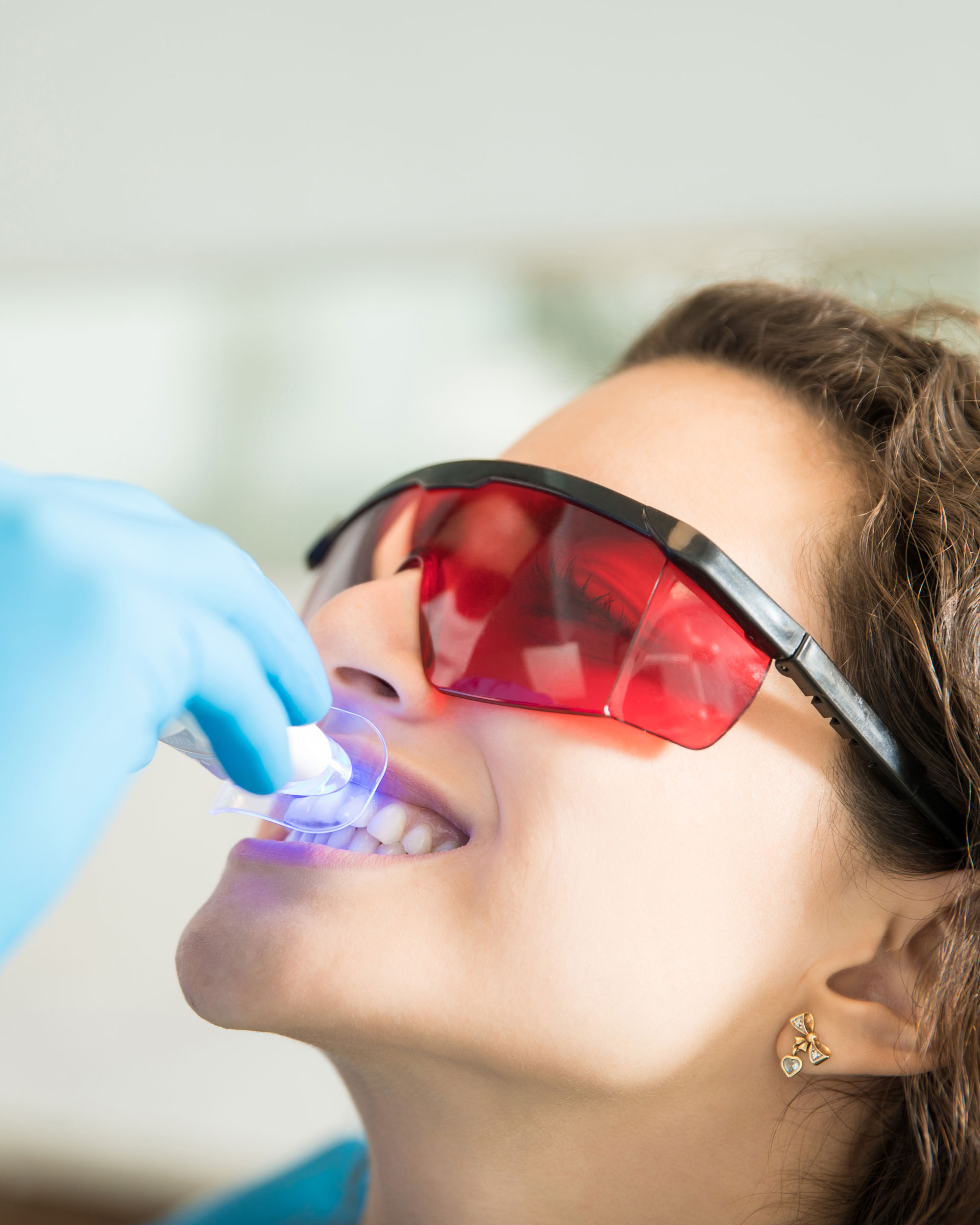 Teeth Whitening in Dubai
